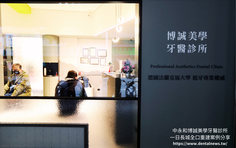 【新北植牙推薦】中永和博誠美學牙醫診所一日長城全口重建案例分享|一日植牙就找何家銘院長 2 博誠美學一日長城發表會