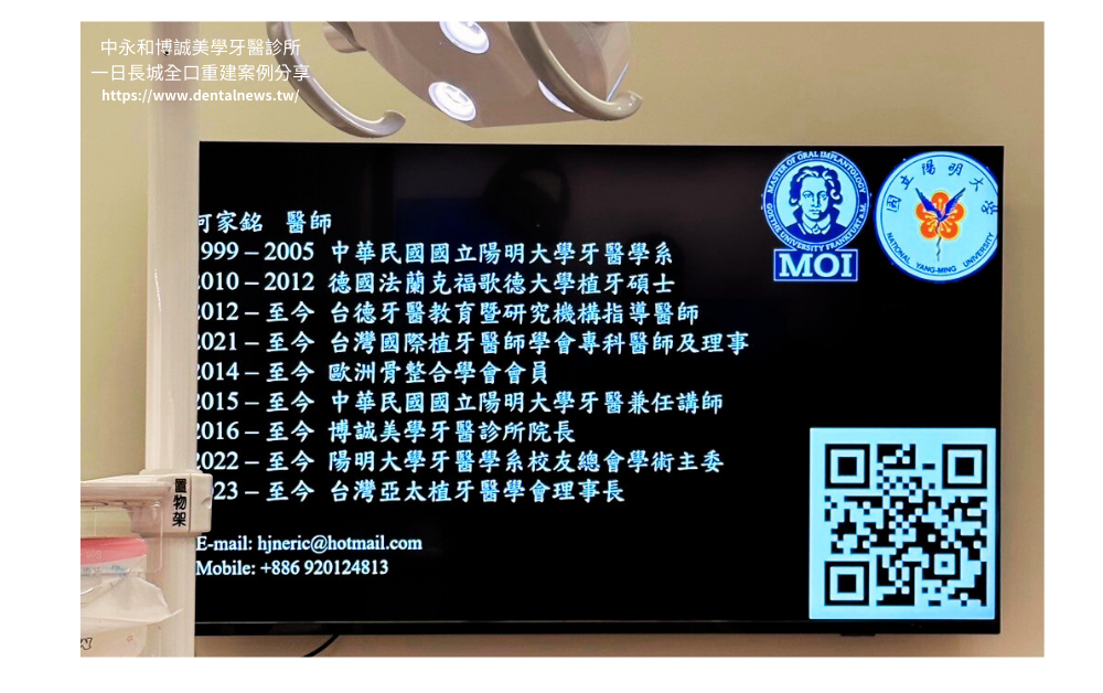 【新北植牙推薦】中永和博誠美學牙醫診所一日長城全口重建案例分享|一日植牙就找何家銘院長 10 博誠美學一日長城發表會