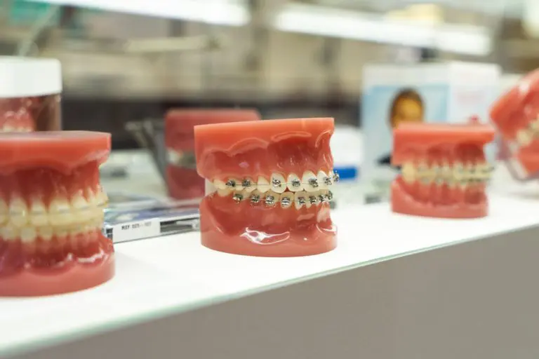 矯正打骨釘痛嗎?醫師說明打骨釘注意事項 14 plastic tooth model for oral health care study and 2021 12 27 17 29 25 utc 3