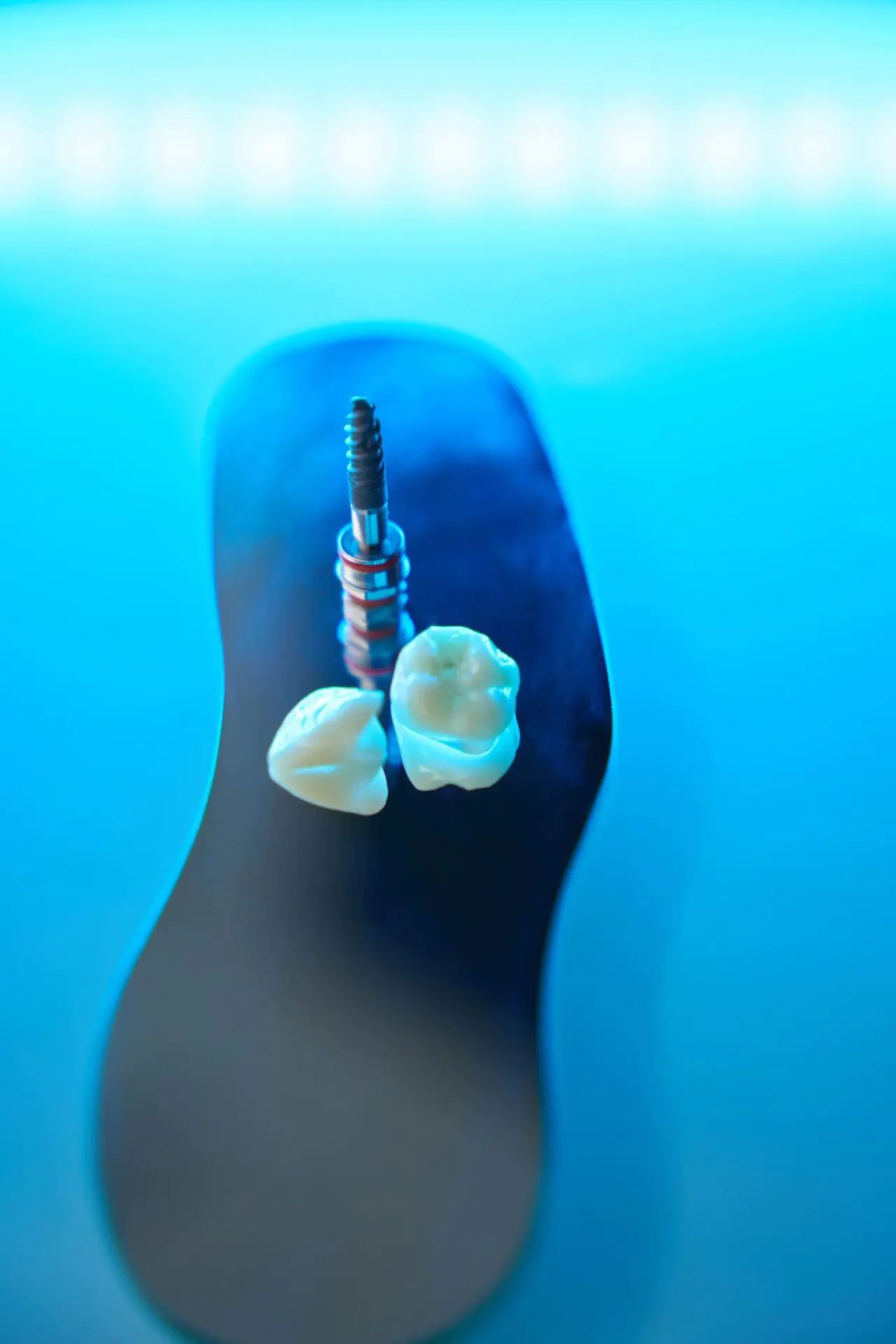 close-up-of-pin-and-chewing-teeth-restoration-of-2022-10-04-01-51-21-utc (1)