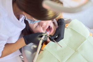 close up dental treatment procedure in dental offi 2023 11 27 05 22 23 utc