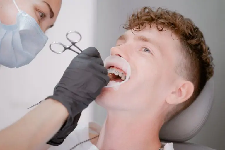 成人牙齒矯正費用會比較高嗎?戽斗矯正費用又是怎麼計算的? 9 the orthodontist fixes the arch with ligatures to 2023 11 27 05 28 25 utc 1