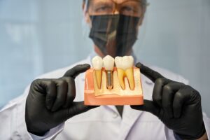 serious dentist showing a teeth model with implant 2023 11 27 05 25 19 utc 1
