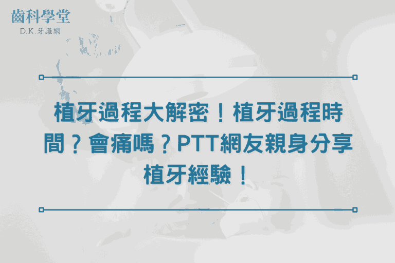 植牙過程大解密！植牙過程時間？會痛嗎？PTT網友親身分享植牙經驗！