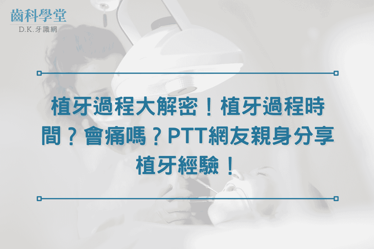 植牙過程大解密！植牙過程時間？會痛嗎？PTT網友親身分享植牙經驗！