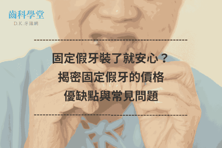 固定假牙裝了就安心？揭密固定假牙的價格、優缺點與常見問題