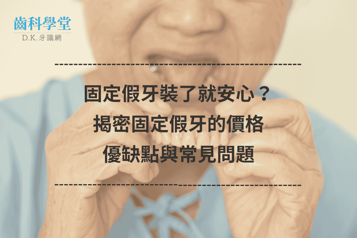 固定假牙裝了就安心？揭密固定假牙的價格、優缺點與常見問題