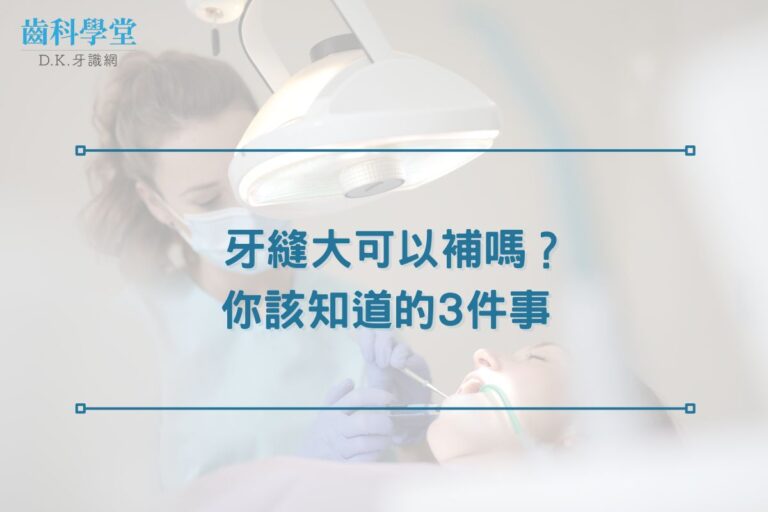 牙縫大可以補嗎？你該知道的3件事