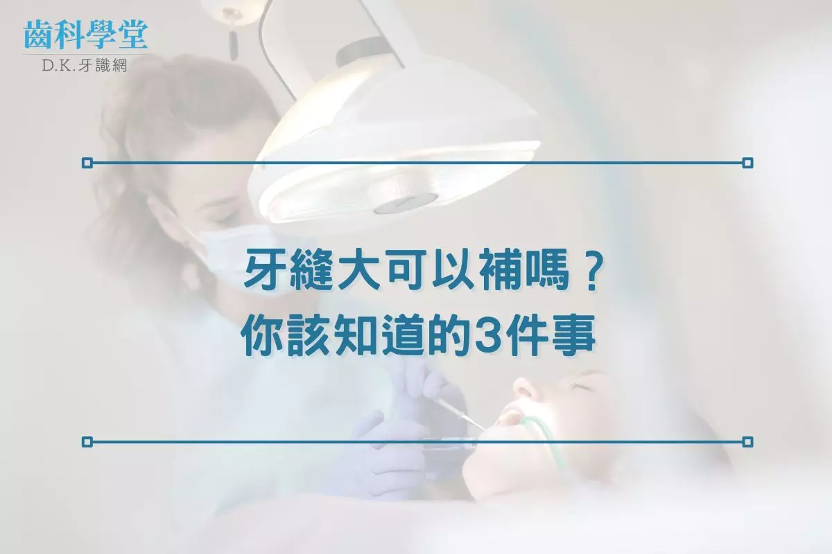 牙縫大可以補嗎？你該知道的3件事