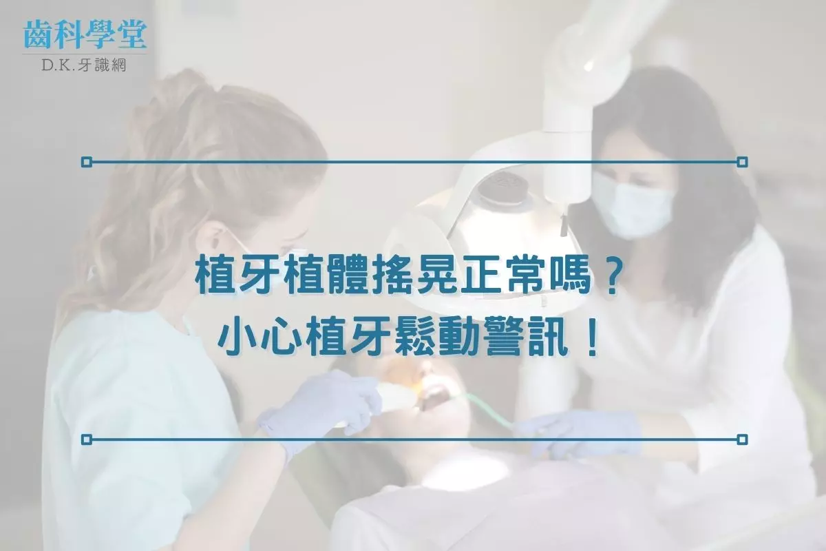 植牙植體搖晃正常嗎？小心植牙鬆動警訊！