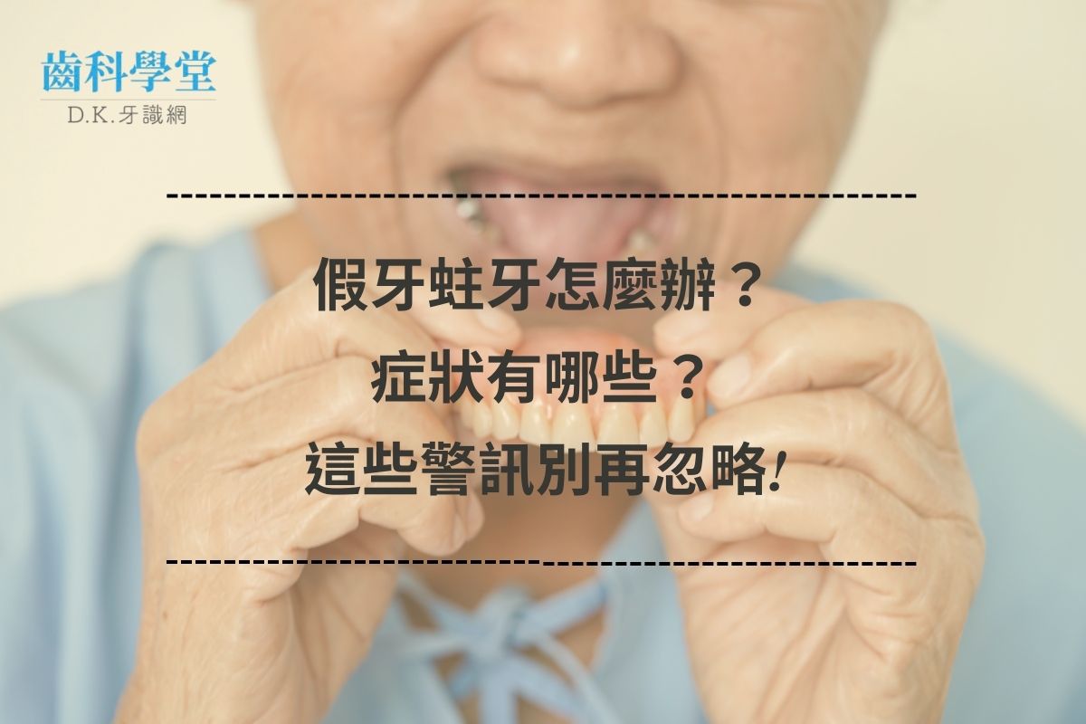 假牙蛀牙怎麼辦？症狀有哪些？這些警訊別再忽略!