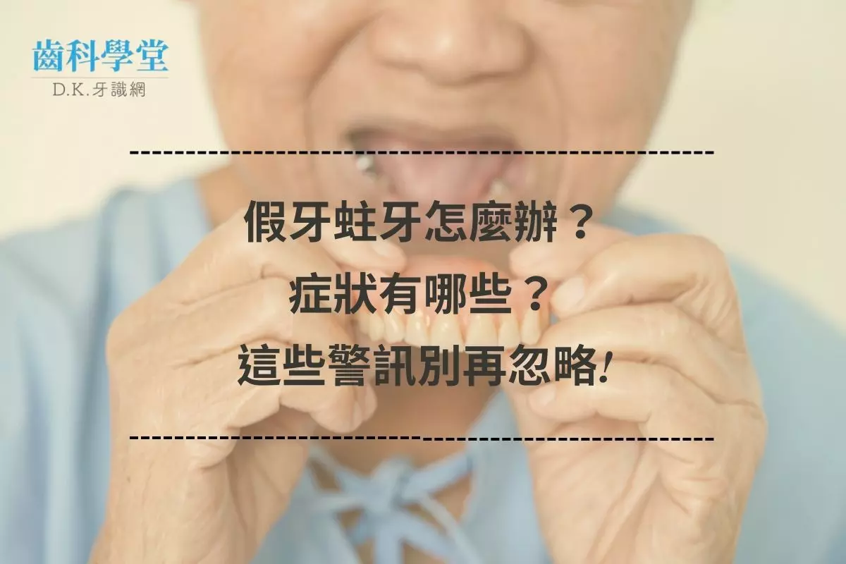 假牙蛀牙怎麼辦？症狀有哪些？這些警訊別再忽略!