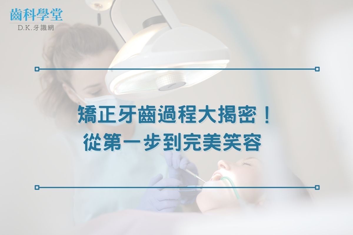 矯正牙齒過程大揭密！從第一步到完美笑容 