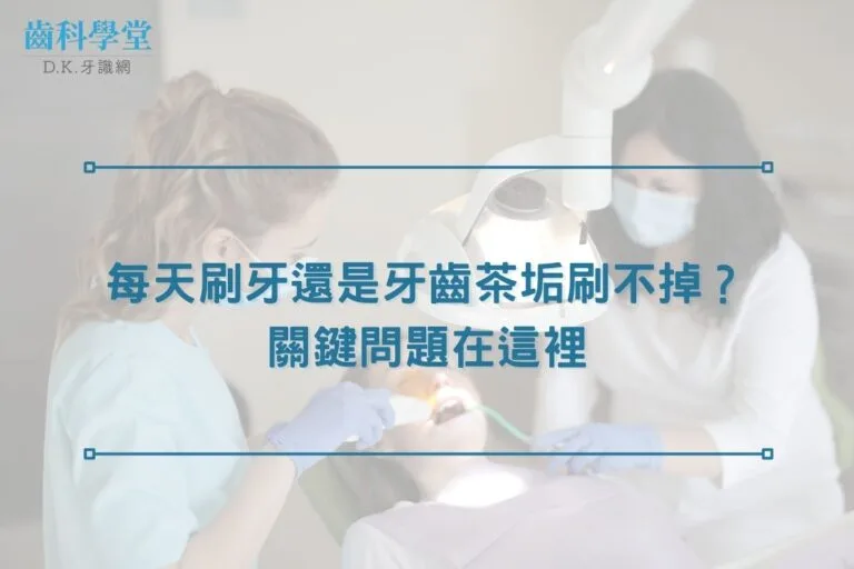 每天刷牙還是牙齒茶垢刷不掉?關鍵問題在這裡 4 每天刷牙還是牙齒茶垢刷不掉?關鍵問題在這裡
