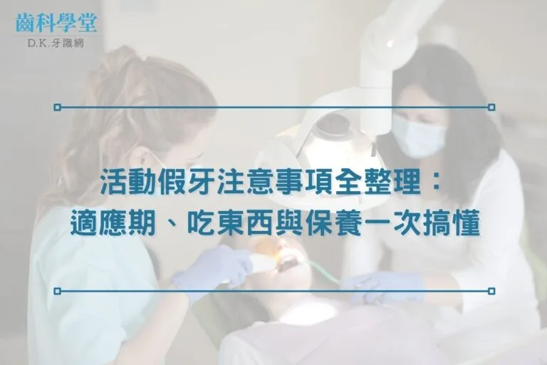 活動假牙注意事項全整理:適應期、吃東西與保養一次搞懂 1 活動假牙注意事項全整理:適應期、吃東西與保養一次搞懂