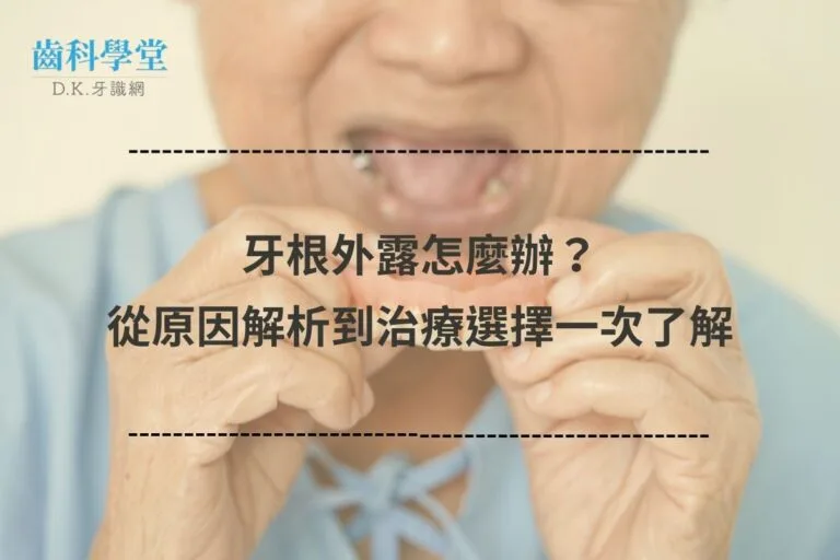 牙根外露怎麼辦?從原因解析到治療選擇一次了解 5 牙根外露怎麼辦?從原因解析到治療選擇一次了解