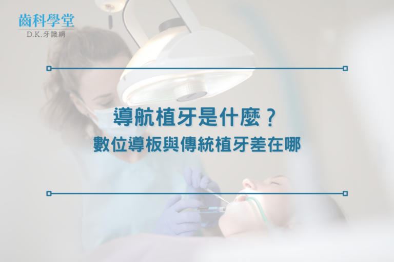 導航植牙是什麼？數位導板與傳統植牙差在哪