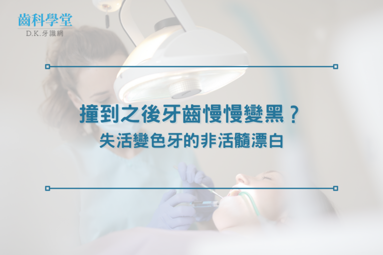 撞到之後牙齒慢慢變黑？失活變色牙的非活髓漂白