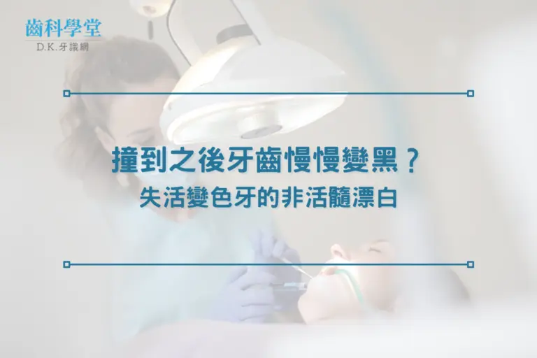 撞到之後牙齒慢慢變黑？失活變色牙的非活髓漂白