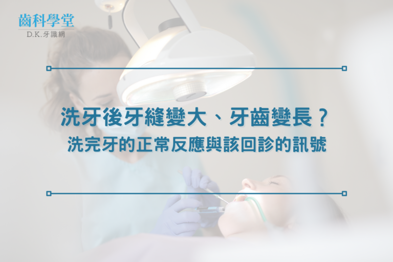 洗牙後牙縫變大、牙齒變長？洗完牙的正常反應與該回診的訊號