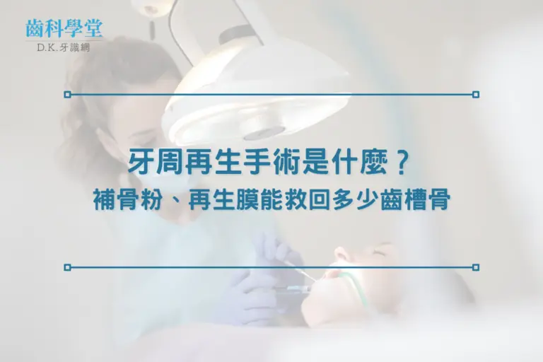 牙周再生手術是什麼？補骨粉、再生膜能救回多少齒槽骨