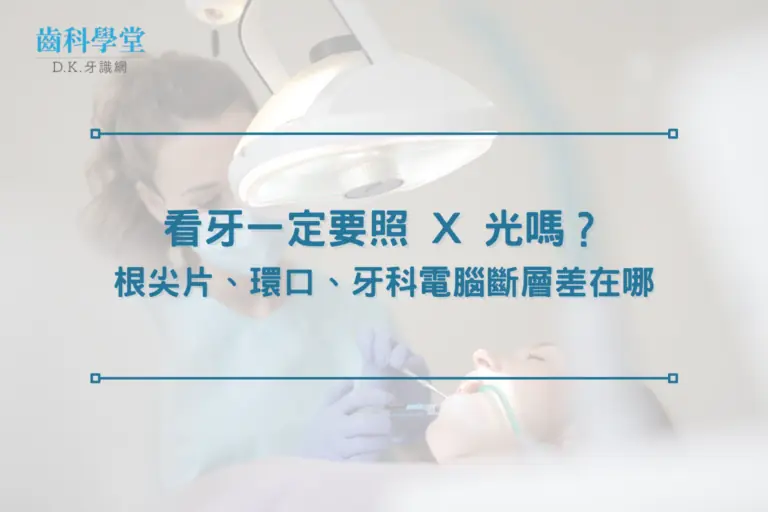 看牙一定要照 X 光嗎？根尖片、環口、牙科電腦斷層差在哪