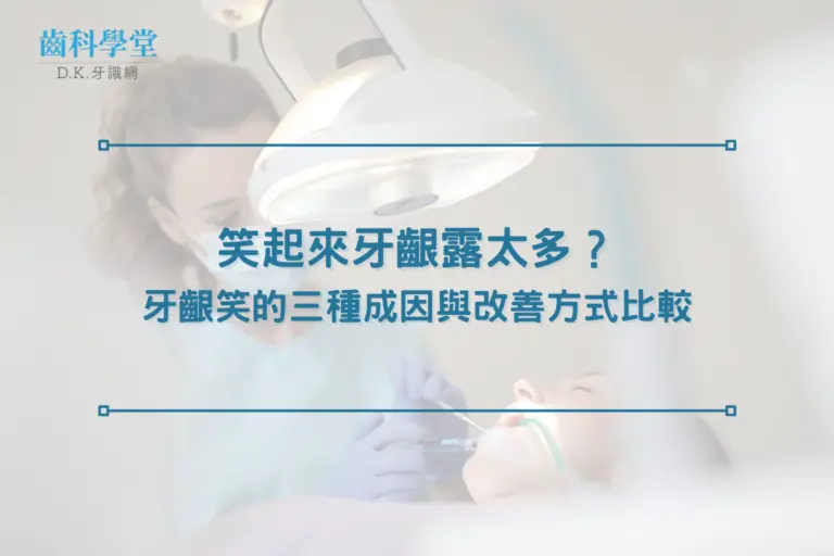 笑起來牙齦露太多？牙齦笑的三種成因與改善方式比較