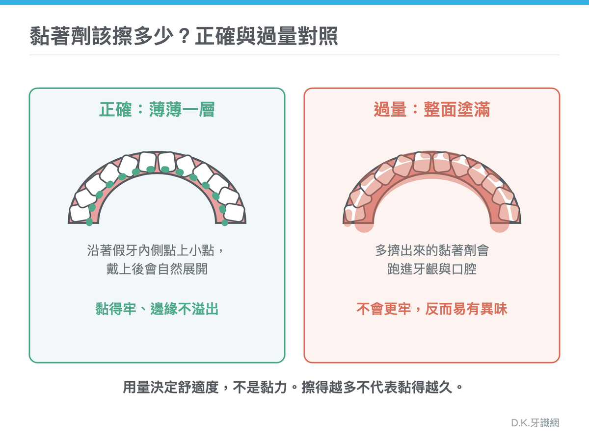 假牙黏著劑用量對照：正確薄薄一層與過量整面塗滿