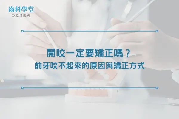 開咬一定要矯正嗎？前牙咬不起來的原因與矯正方式