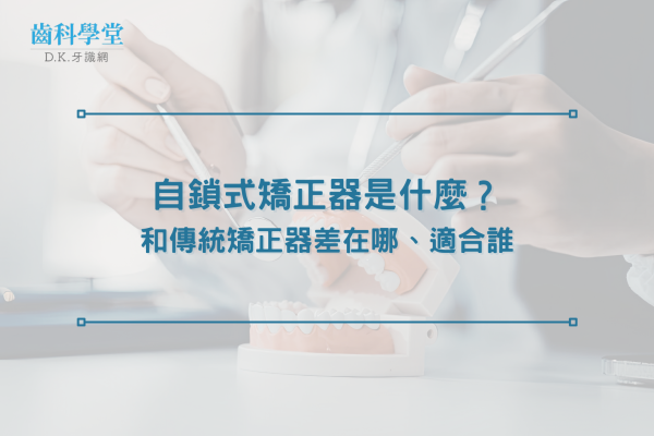 自鎖式矯正器是什麼？和傳統矯正器差在哪、適合誰