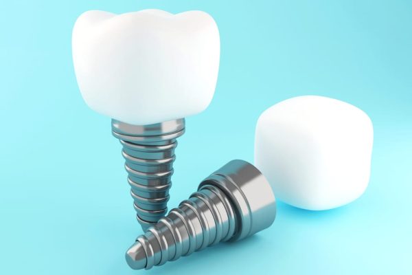 3d dental tooth implant 2021 08 29 10 14 31 utc