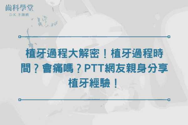 植牙過程大解密！植牙過程時間？會痛嗎？PTT網友親身分享植牙經驗！