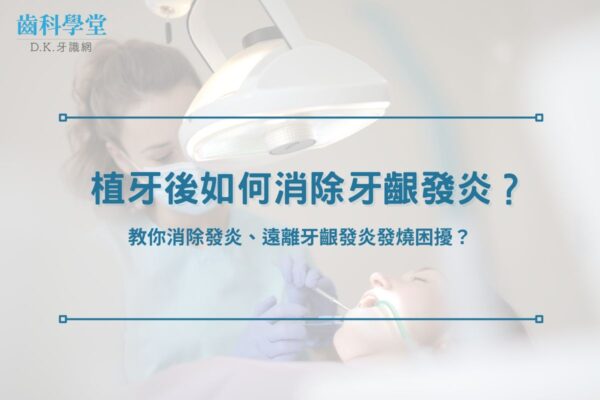 教你消除發炎、遠離牙齦發炎發燒困擾？