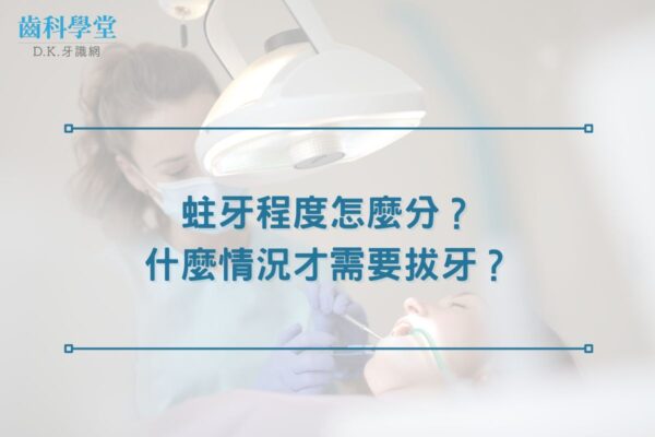 蛀牙程度怎麼分？什麼情況才需要拔牙？