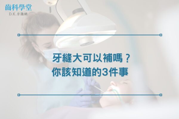 牙縫大可以補嗎？你該知道的3件事