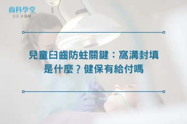 兒童臼齒防蛀關鍵：窩溝封填是什麼？健保有給付嗎