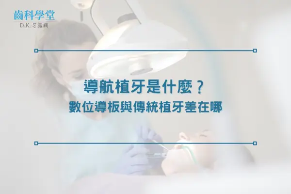 導航植牙是什麼？數位導板與傳統植牙差在哪