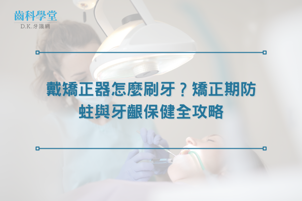 戴矯正器怎麼刷牙？矯正期防蛀與牙齦保健全攻略