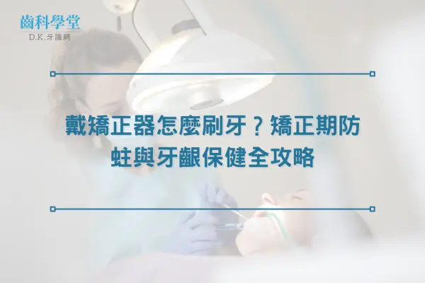 戴矯正器怎麼刷牙？矯正期防蛀與牙齦保健全攻略