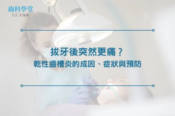 拔牙後突然更痛？乾性齒槽炎（乾窩症）的成因、症狀與預防