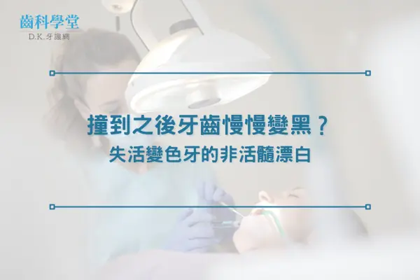 撞到之後牙齒慢慢變黑？失活變色牙的非活髓漂白