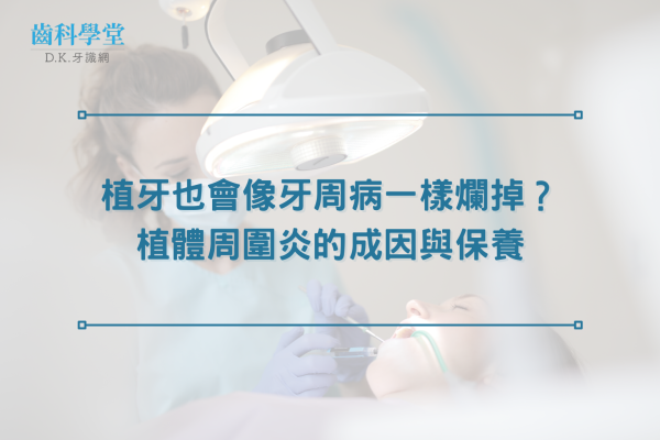 植牙也會像牙周病一樣爛掉？植體周圍炎的成因與保養