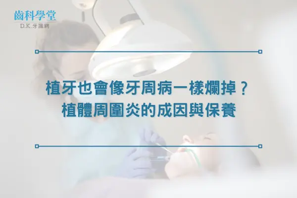 植牙也會像牙周病一樣爛掉？植體周圍炎的成因與保養
