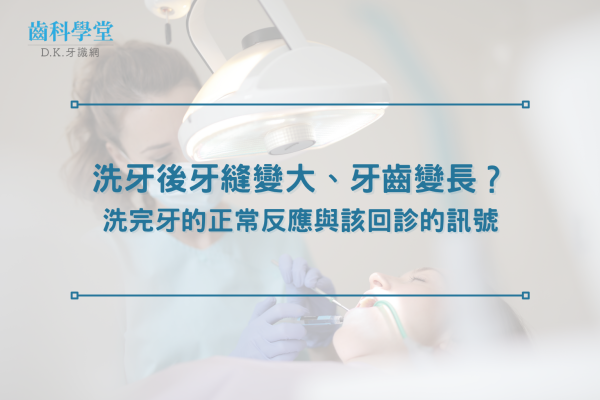 洗牙後牙縫變大、牙齒變長？洗完牙的正常反應與該回診的訊號