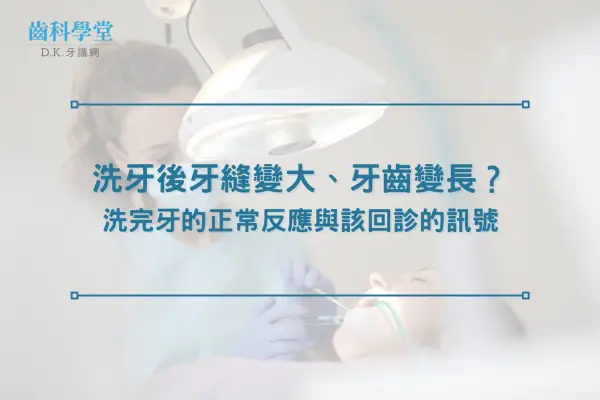 洗牙後牙縫變大、牙齒變長？洗完牙的正常反應與該回診的訊號