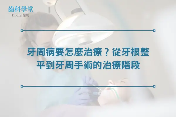 牙周病要怎麼治療？從牙根整平到牙周手術的治療階段