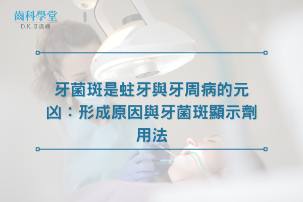 牙菌斑是蛀牙與牙周病的元凶：形成原因與牙菌斑顯示劑用法