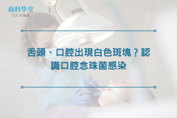 舌頭、口腔出現白色斑塊？認識口腔念珠菌感染