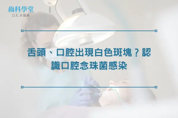 舌頭、口腔出現白色斑塊？認識口腔念珠菌感染