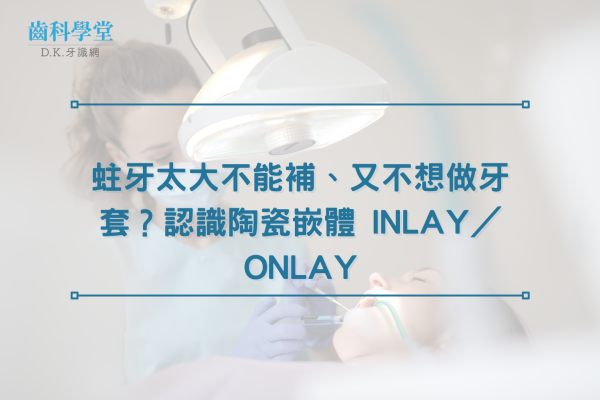 蛀牙太大不能補、又不想做牙套？認識陶瓷嵌體 Inlay／Onlay